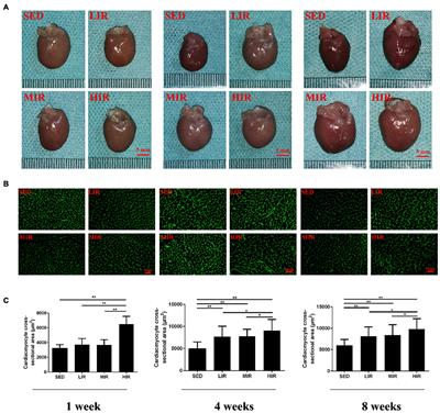 Cardiac Effects of Treadmill Running at Different Intensities in a Rat Model